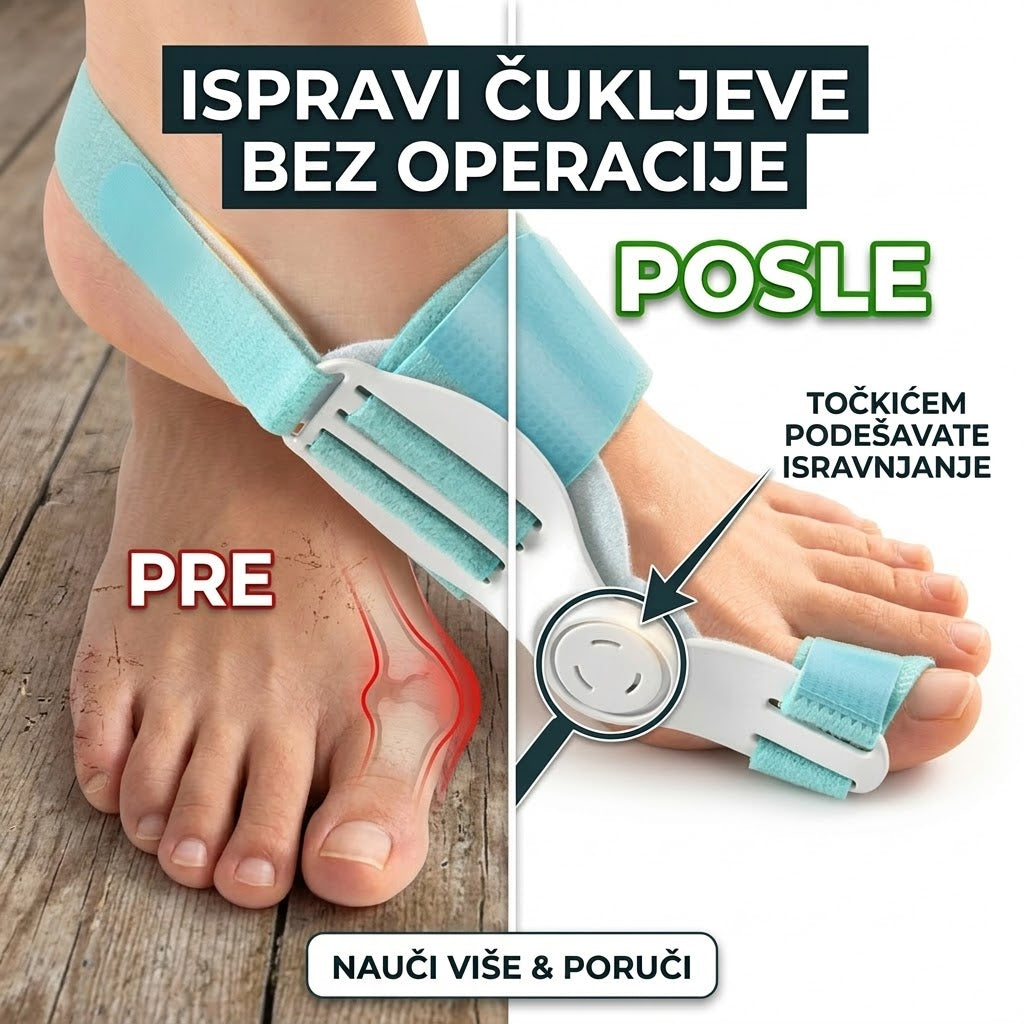 🦶 Longeta sa Točkićima – Reši Čukalj Bez Operacije!